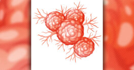 Les cancers en 2026 : entre craintes et espoirs - Partie 2